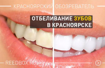 Отбеливание зубов в Красноярске